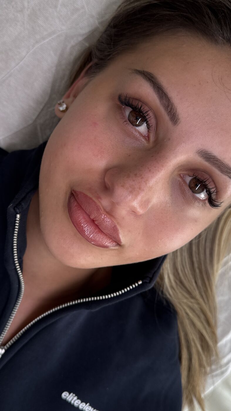 Client's lips right after Lip Blush