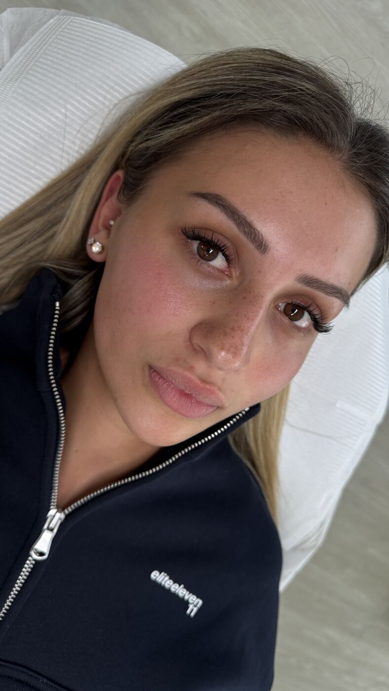 Client's natural lips before Lip Blush