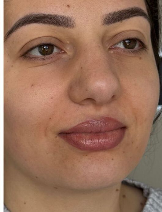 Client's lips right after Lip Blush
