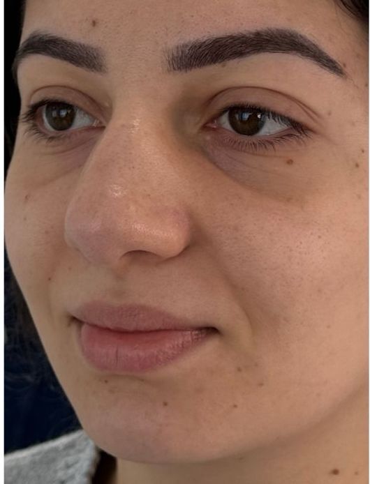 Client's natural lips before Lip Blush