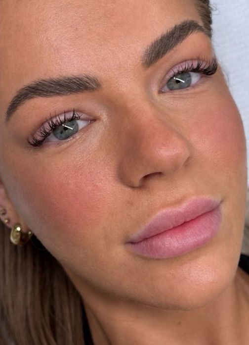 Client's natural lips before Lip Blush